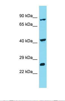 INTS10 Antibody (aa523-572)