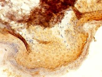 Polyclonal Rabbit anti-Human IFIT5 Antibody (IHC, WB)