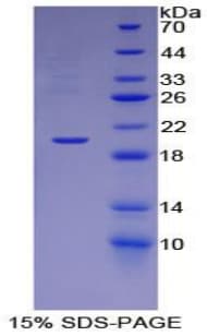 Rat ESM1 / Endocan Protein (Recombinant His)