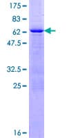 Human XPA Protein (Recombinant GST)