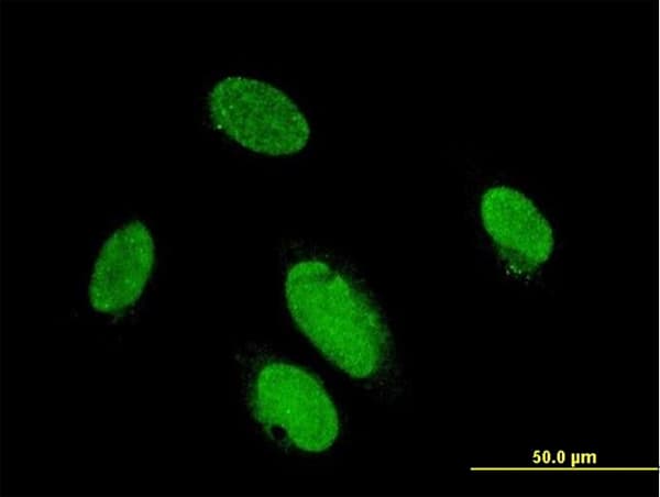 PITX2 / RGS Antibody (clone 2G6)