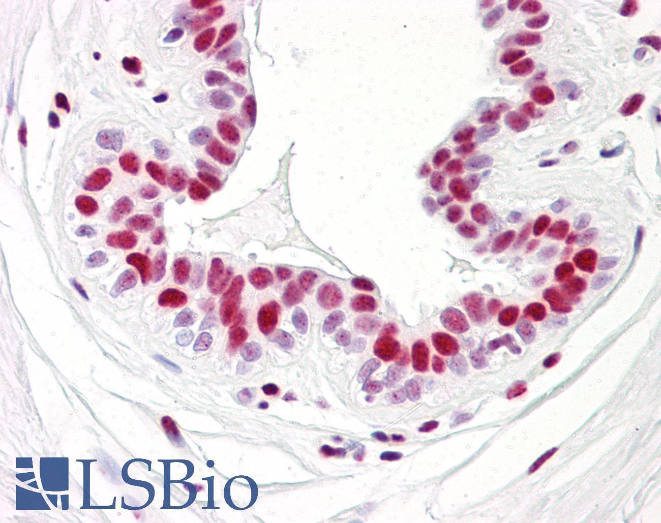 IHC-plus™ PR / Progesterone Receptor Antibody (aa371-420)