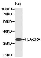 Polyclonal Rabbit anti-Human HLA-DRA Antibody (IHC, WB)