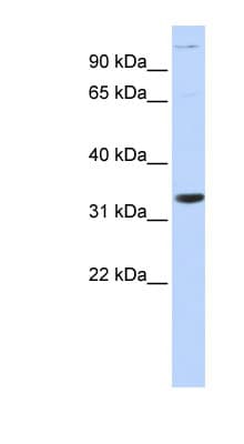 ANP32B Antibody (aa36-85)