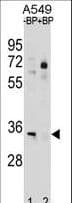 AMOG / ATP1B2 Antibody (aa247-276)