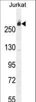 Polyclonal Rabbit anti-Human CAD Antibody (aa780-809, IHC, WB)
