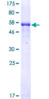 Human FCN1 / Ficolin-1 Protein (Recombinant GST)