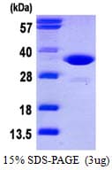 Human CDK2 Protein (Recombinant His)