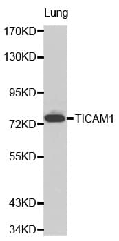 Polyclonal Rabbit anti-Human TICAM1 / TRIF Antibody (IHC, WB)
