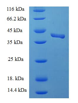 Human ESAM Protein (Recombinant His-SUMO)