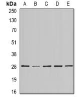 BAP29 / BCAP29 Antibody