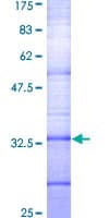 Human SSTR2 Protein (Recombinant GST, N-terminus)