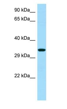 Polyclonal Rabbit anti-Human RBFA Antibody (aa257-306, WB)