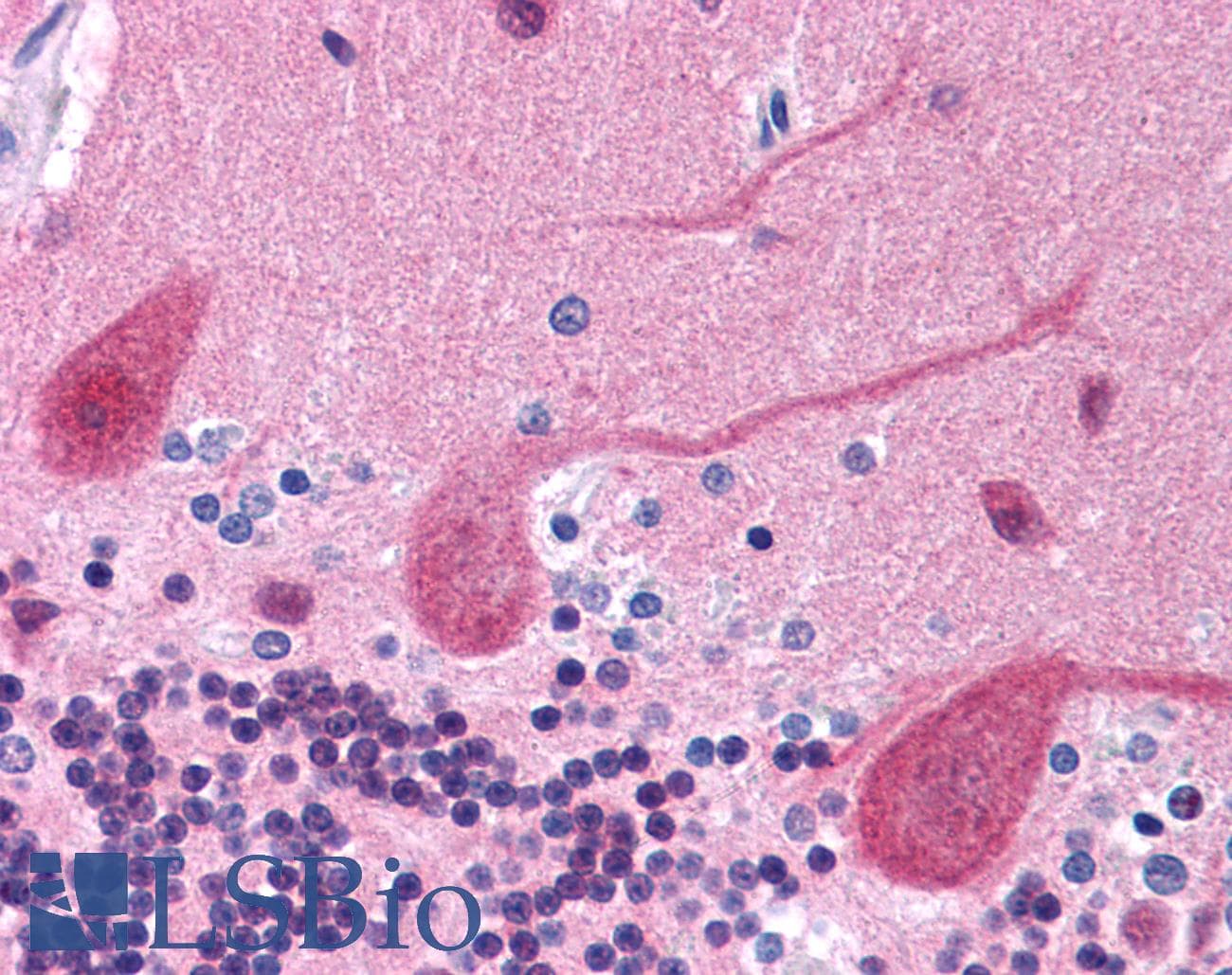 IHC-plus™ Polyclonal Rabbit anti-Human GRB2 Antibody (clone Polyclonal, C-Terminus, IHC, WB)