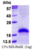 Human VEGFA / VEGF Protein (Recombinant)