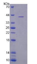 Mouse NALP3 / NLRP3 Protein (Recombinant His, N-Terminal)