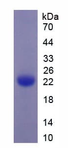 Mouse PLAT / TPA Protein (Recombinant His)