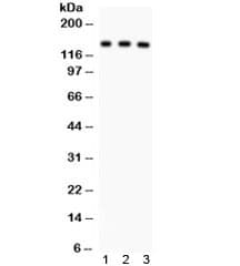 Polyclonal Rabbit anti-Human ABCB11 / BSEP Antibody (IHC, WB)