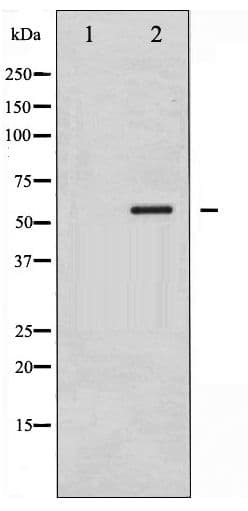 CAMK4 / CaMK IV Antibody (phospho-Thr196/200)