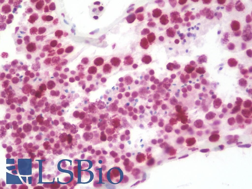 IHC-plus™ Polyclonal Rabbit anti-Human CD274 / B7-H1 / PD-L1 Antibody (aa261-290, IHC, WB)
