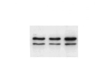 LMNA / Lamin A+C Antibody (N-Terminus, clone JoL5)
