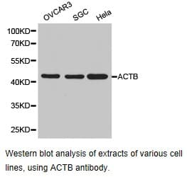 Polyclonal Rabbit anti-Human CCT4 / SRB Antibody (IHC, WB)