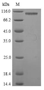 Mouse GP2 Protein (Recombinant 6His, N-terminus)