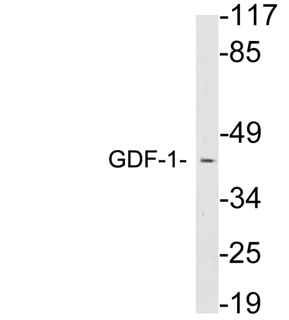 Polyclonal Rabbit anti-Human GDF1 Antibody (aa210-259, WB)