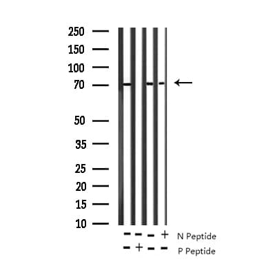 Polyclonal Rabbit anti-Human RPS6KB1 / P70S6K / S6K Antibody (phospho-Ser424, IHC, IF, WB)