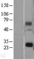 FAM60A Protein (Over-Expression Lysate Myc-DDK (Flag))