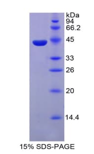 Mouse PTH / Parathyroid Hormone Protein (Recombinant His-GST)