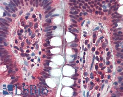 IHC-plus™ BACH1 Antibody (aa350-400)