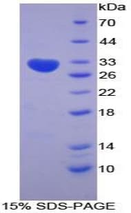 Mouse CCS Protein (Recombinant His-T7)