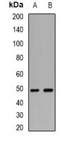 Polyclonal Rabbit anti-Human WIPI2 Antibody (IHC, WB)