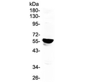 CYP19 / Aromatase Antibody
