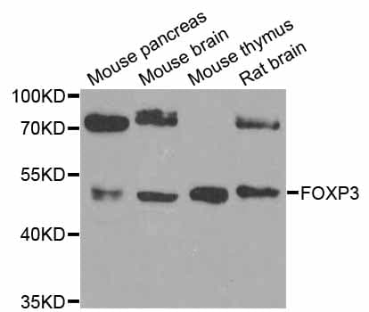 Polyclonal Rabbit anti-Human FOXP3 Antibody (IHC, WB)