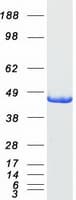 Human AGXT / SPT Protein (Recombinant Myc-DDK (Flag))