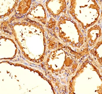 TG / Thyroglobulin Antibody (clone 6E1 or TGB05, Ready-to-Use)