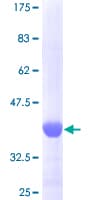 Human FGF1 / Acidic FGF Protein (Recombinant GST, N-terminus)