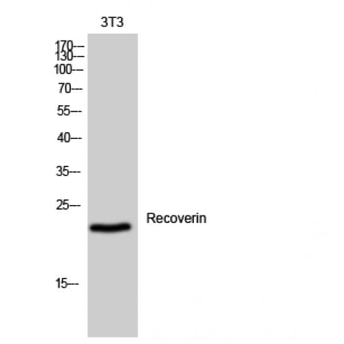Recoverin Antibody (80-160 aa, Internal)