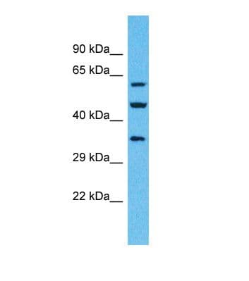 Polyclonal Rabbit anti-Human OR4F6 Antibody (aa205-254, WB)