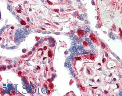 IHC-plus™ Polyclonal Rabbit anti-Human CDKN1C / p57 Kip2 Antibody (aa225-275, IHC)