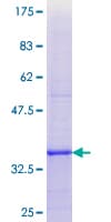 Human DIO1 / TXDI1 Protein (Recombinant GST, N-terminus)