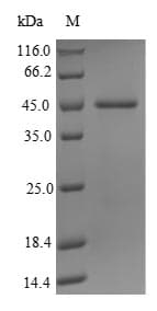 Human JMJD1C Protein (Recombinant 10His-SUMO, N-terminus + Myc, C-terminus)