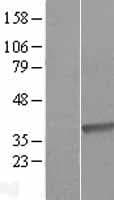 DHRS9 Protein (Over-Expression Lysate Myc-DDK (Flag))