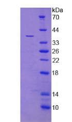 Human Procollagen III N-Terminal Propeptide Protein (Recombinant His, N-Terminal)