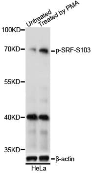Polyclonal Rabbit anti-Human SRF / Serum Response Factor Antibody (phospho-Ser103, WB)