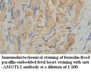 AMOTL2 Antibody (aa6-235)