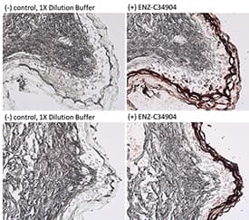 Monoclonal Mouse anti-Human KRT1 / CK1 / Cytokeratin 1 Antibody (clone 34BetaB4, IHC, WB)