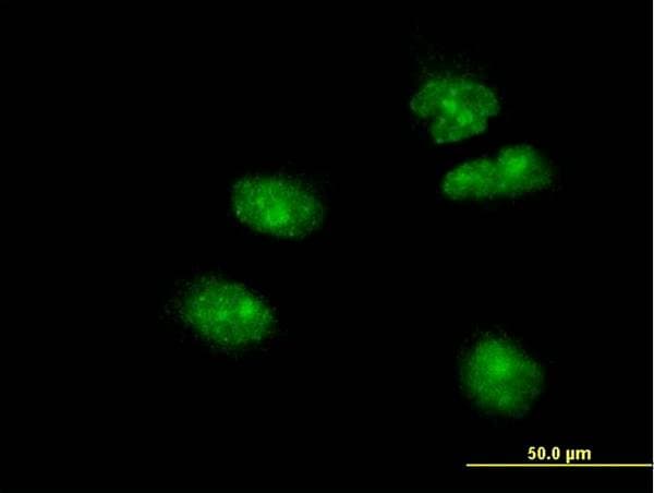 Monoclonal Mouse anti-Human FOXA2 Antibody (clone 4G11, IF, WB)